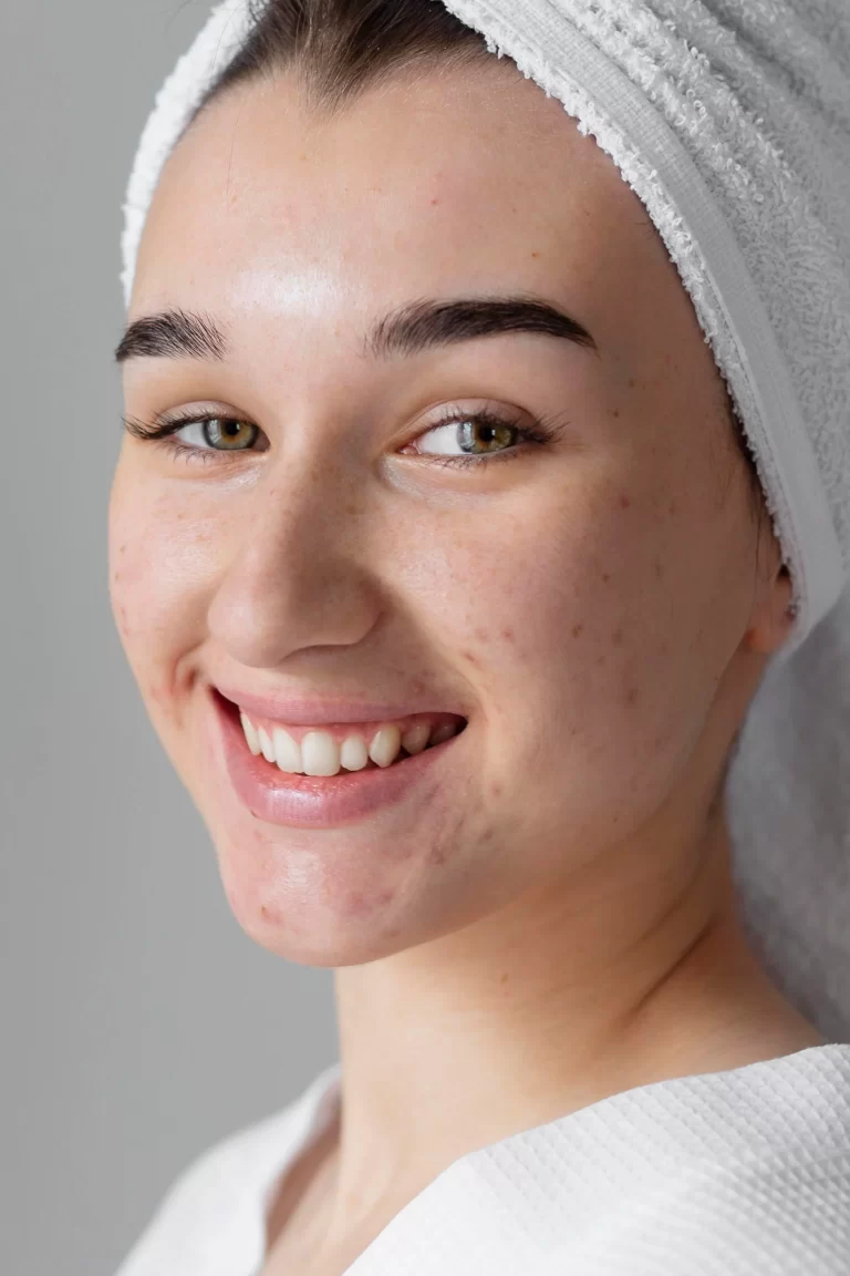 11 Acne Myths You’ve Probably Heard (But Definitely Shouldn’t Believe)